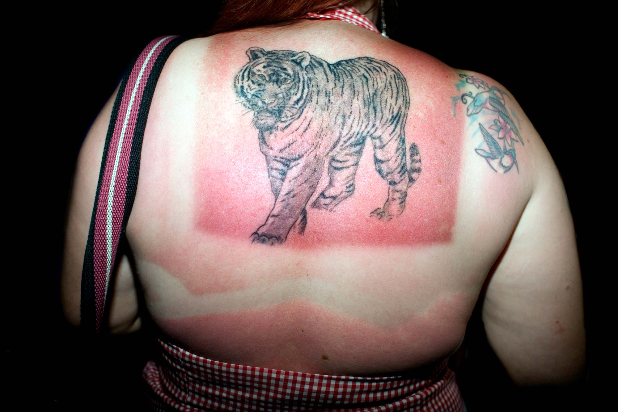 Solforbrændt kvinde, der har glemt at smører i solcreme og nu trænger til sun lotion. - Pepbercorn